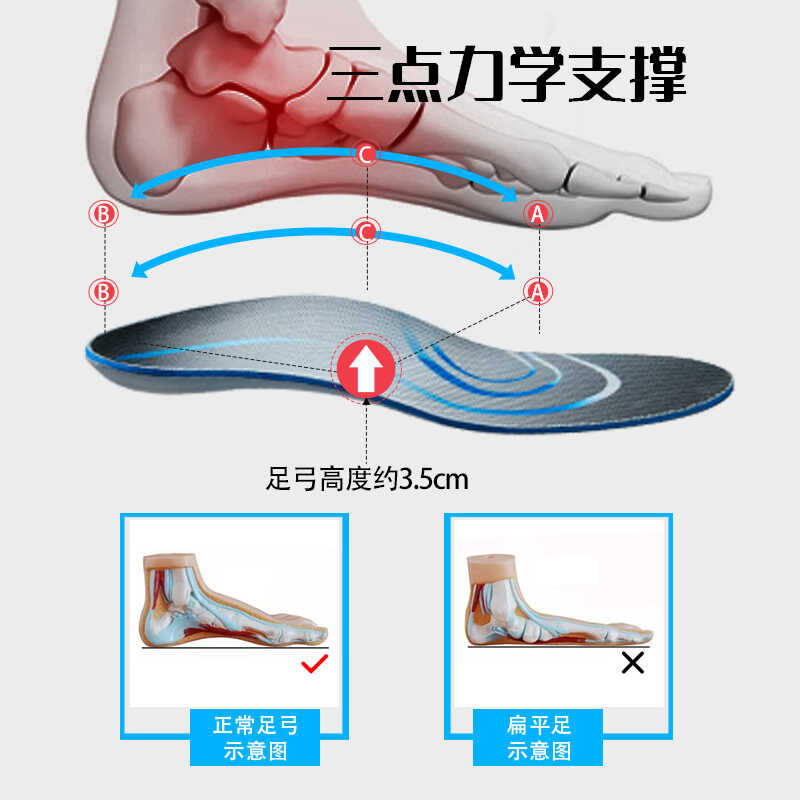 3D定制矫正鞋垫扁平足外翻儿童内外八字脚成人足弓垫XO腿型矫形器 - 图1