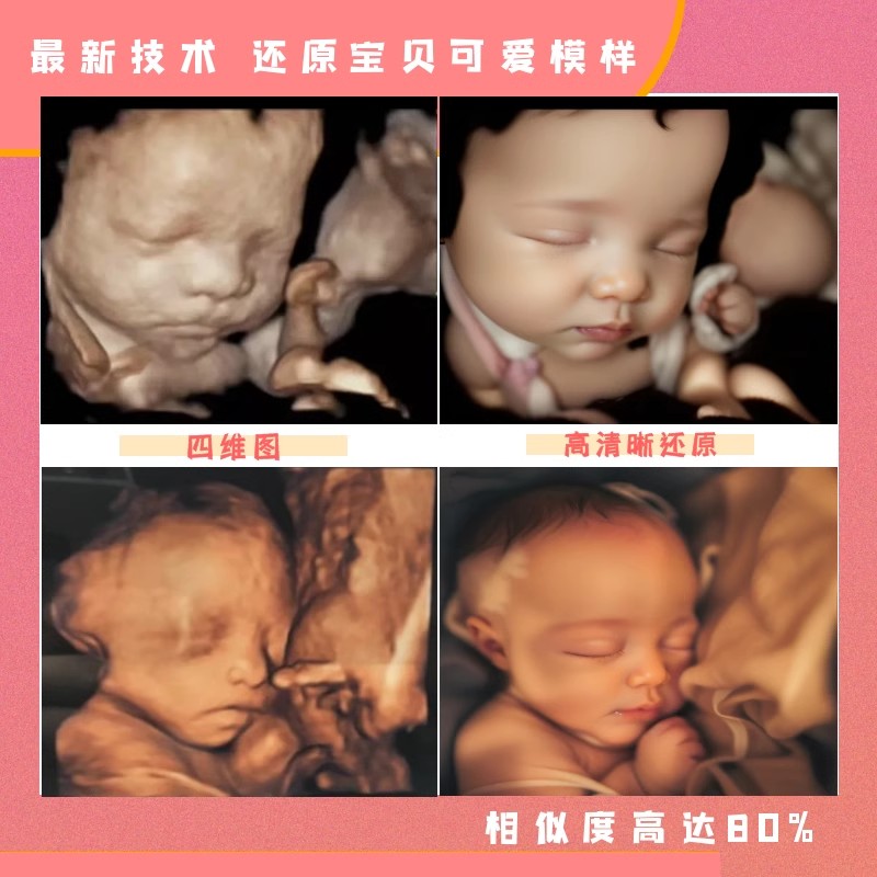 宝宝三四维彩超AI深度预测胎儿长相高清还原模样五维婴儿照片成像 - 图1