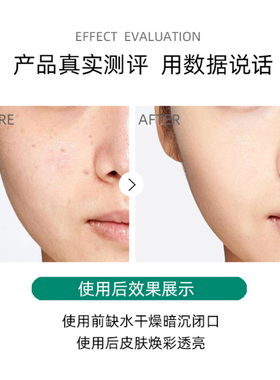 奥尔滨健康水精萃液闭口痘控油