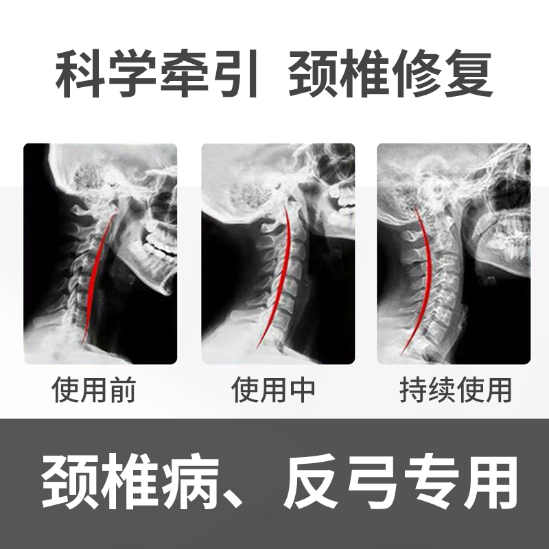 颈椎枕非牵引矫正器睡觉专用修复曲度变直富贵包枕护颈枕头助睡眠