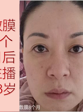 【主播使用面膜】中药面膜眼袋眼角纹法令纹紧致提亮黑色素