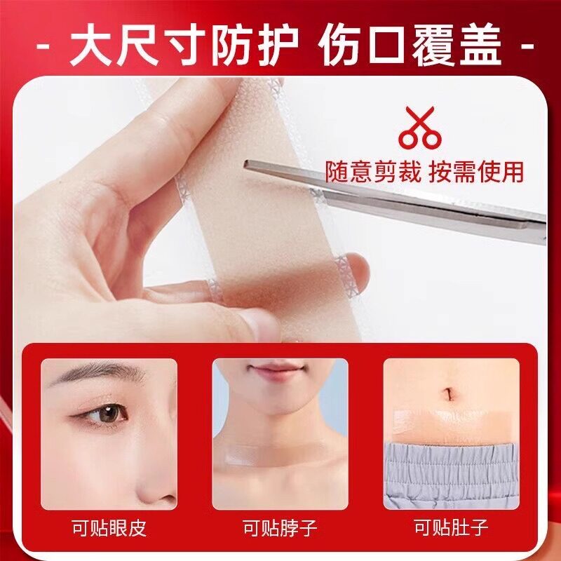 修正医用疤痕贴剖腹产手术增生痘印烧烫伤祛疤痕修复除疤硅酮凝胶
