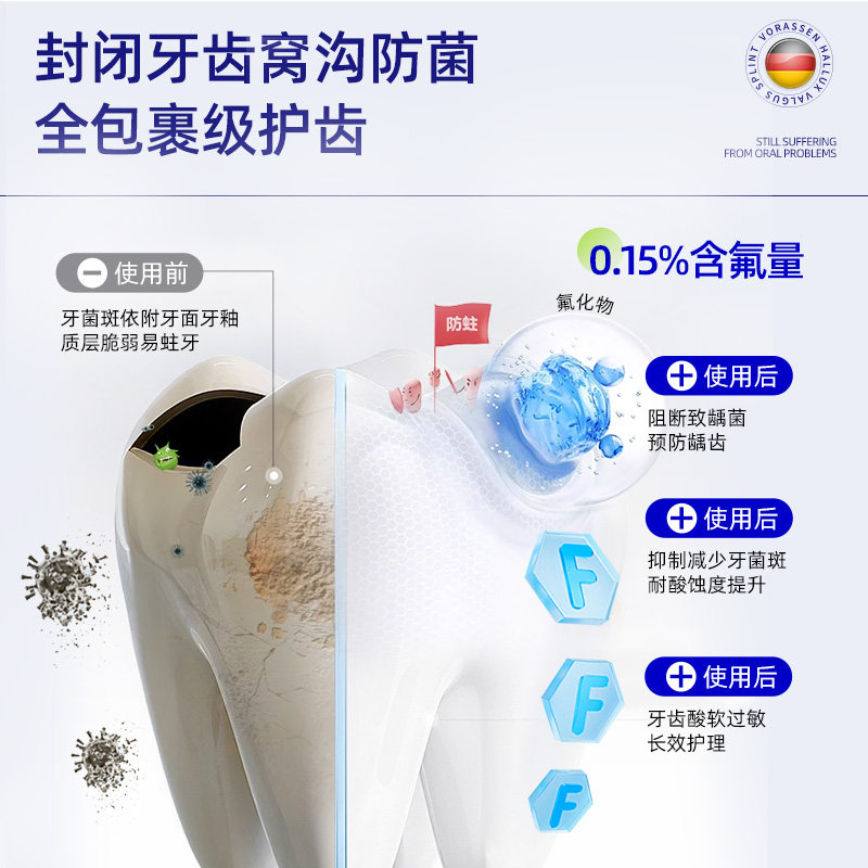 沃朗森防龋膏含氟成人防蛀牙龋齿专用去改善口臭复牙过敏医用正品 - 图2