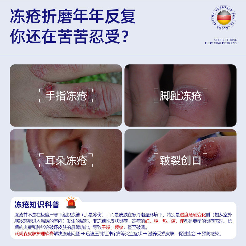 医用冻疮膏冻伤膏儿童预防皲裂脱皮护手足耳朵修护霜正品复非止痒,淘宝优惠券,粉丝福利购,淘宝优惠卷