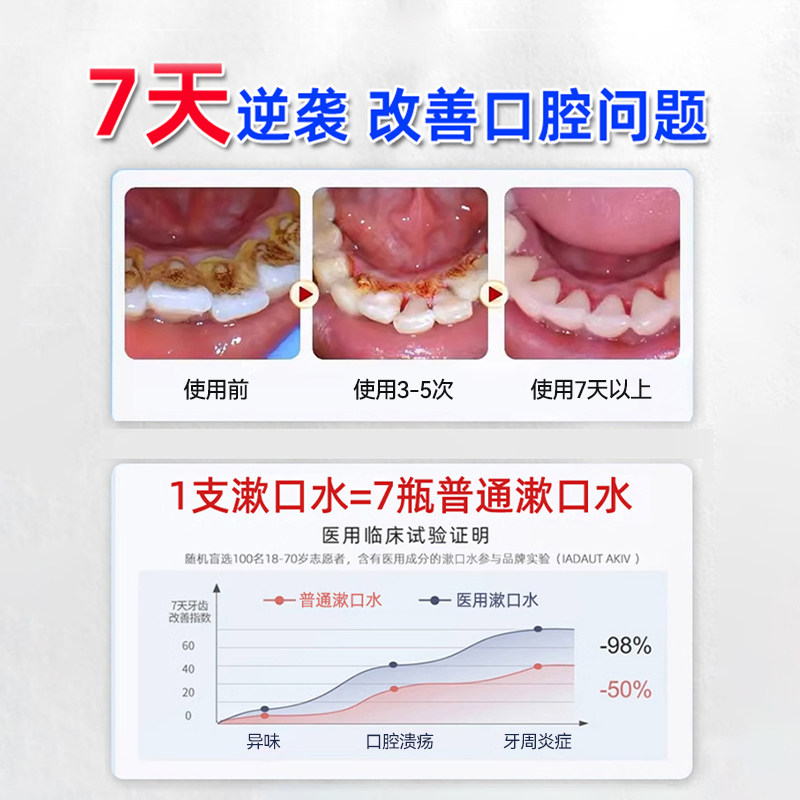 医用漱口水条装便携牙周炎症杀菌消炎除异味持久留香缓解口腔溃疡,淘宝优惠券,粉丝福利购,淘宝优惠卷
