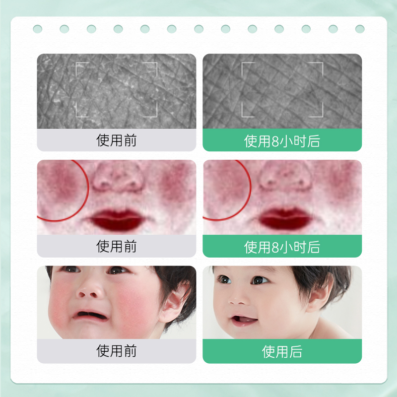 松达婴儿山茶油面霜宝宝秋冬补水保湿霜68g*2新生润肤乳儿童面霜