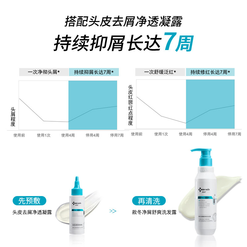 域发洗发水款冬去屑止痒洗发露洗头膏300ml去屑蓬松清爽持久