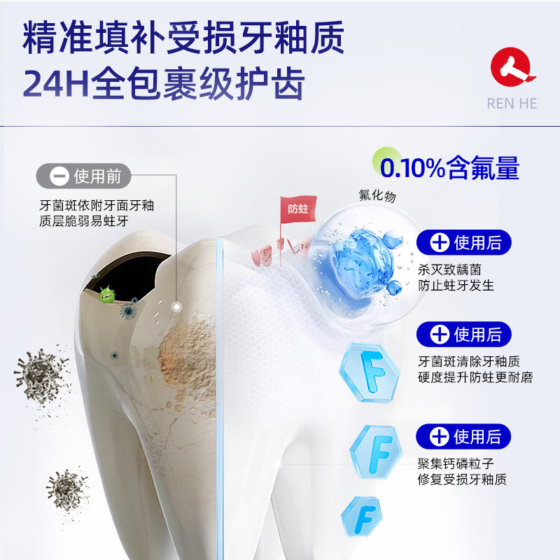 仁和牙齿防龋膏抗敏含氟预防龋齿牙龈炎牙周炎口臭黄黑板牙酸软膏,淘宝优惠券,粉丝福利购,淘宝优惠卷