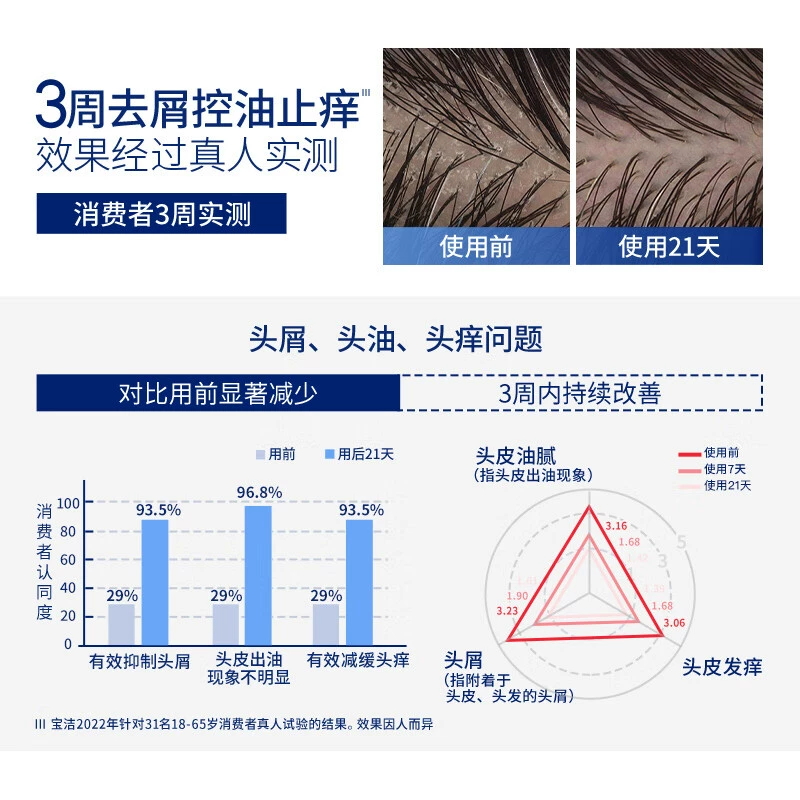 海飞丝洗发水专研去屑洗发露控油头皮护理无硅油470g正品