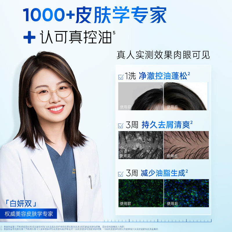 海飞丝控油蓬松头皮护理洗发水去屑舒缓止痒柔顺水杨酸洗头膏男士