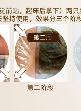 拍1件发5包50贴足贴