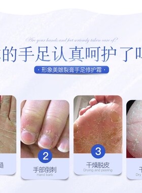 滋润保湿防冻裂龟裂新喜乐