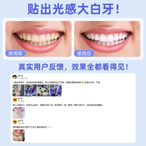 佳洁士亮白牙贴现货诊所香港美国3d闪耀牙齿去黄5对10片加强美白 - 图0