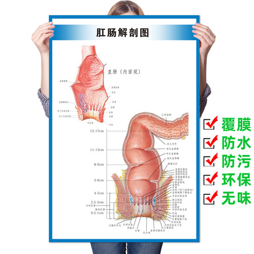 肛肠常见痔疮疾病图例墙贴纸肛肠科解剖图医院挂图广告宣传海报 - 图0