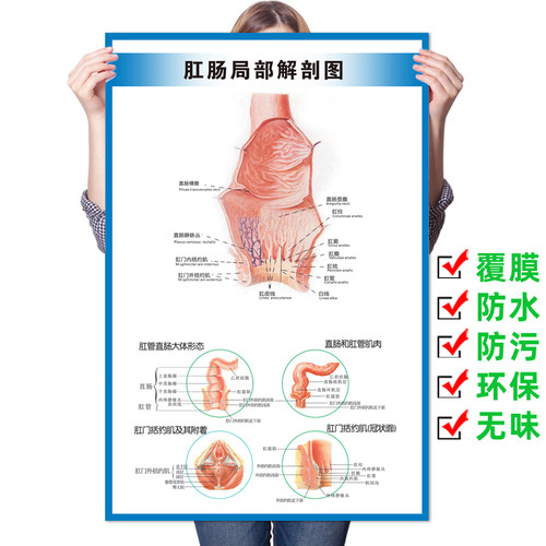 肛肠常见痔疮疾病图例墙贴纸肛肠科解剖图医院挂图广告宣传海报 - 图2