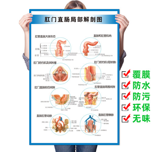 肛肠常见痔疮疾病图例墙贴纸肛肠科解剖图医院挂图广告宣传海报 - 图1