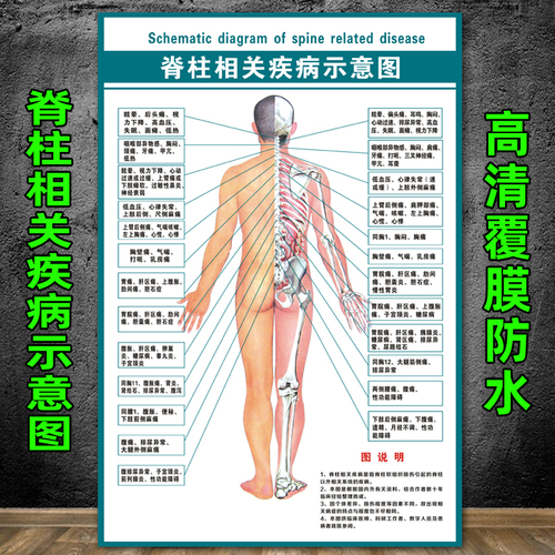 脊椎健康速查表人体脊柱相纸疾病示意图中医养生医学健康挂图海报