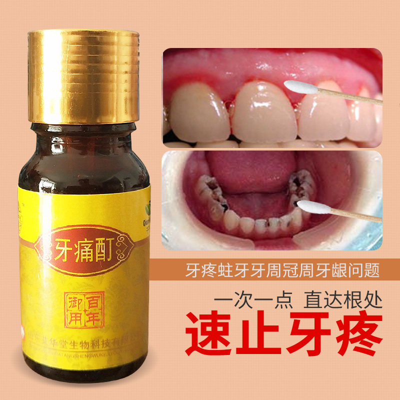 牙疼牙痛智齿发炎上火牙龈肿痛孕妇蛀虫牙神经专用速效止疼中药水