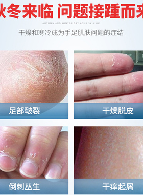 正品爆拆灵50g秋冬保湿护手霜