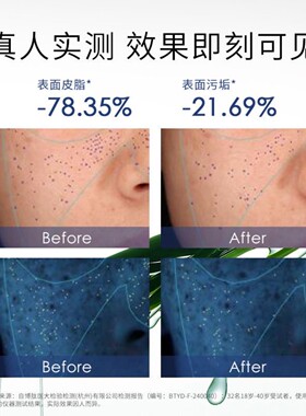 华西专利安碧妍氨基酸净透舒颜洗面奶120ml洁面乳敏感肌可用清洁
