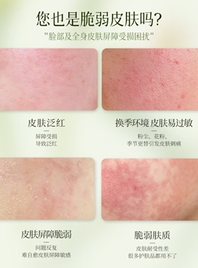 阅肤皮肤屏障修护霜修复霜
