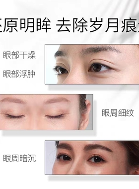 易草轩美眼舒悦精油20ml/瓶品专柜滋养细胞眼部精华液提拉紧致
