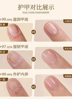 美甲东方香指缘油滋润修护甲面防倒刺营养油美甲店专用软管护甲油