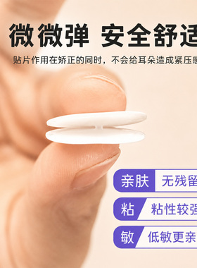 硅胶招风耳矫正贴成人定型