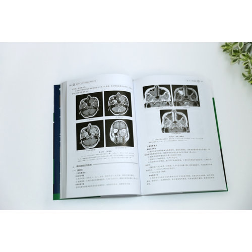 影像读片从入门到精通系列 MRI读片指南第三版 影像学诊断超声图谱医学诊断学检查技术基础教程 强化思路技巧病种齐全病例典型图片 - 图2