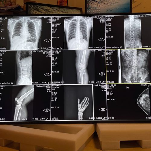 日电 NEC高清大屏4K显示器医疗会诊液晶屏 86寸 M861 98寸 M981 - 图1