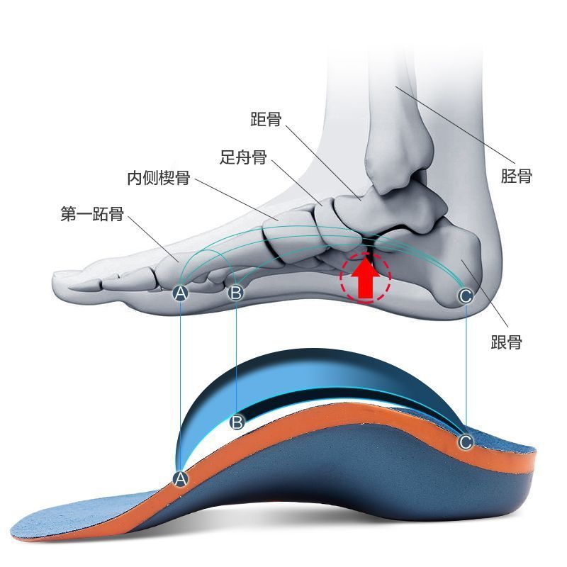 儿童足外翻扁平足矫正鞋垫内八字足弓支撑矫正鞋垫XO型腿医用鞋垫 - 图1