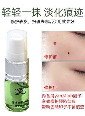正品yx点痣扫班修复液