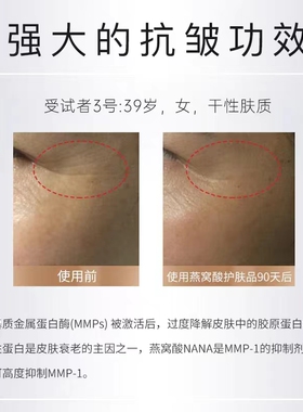 燕肌源抗皱抗衰燕窝精华燕窝酸