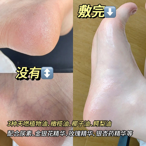 日本Lucky Trendy手膜足膜保湿滋润防干裂软化角质嫩白手脚部护理 - 图2