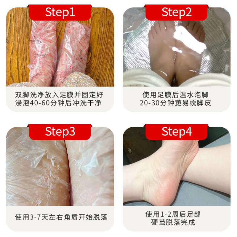 日本babyfoot足膜去死皮老茧角质脚后跟开裂干燥脱皮嫩白保湿脚膜-图2