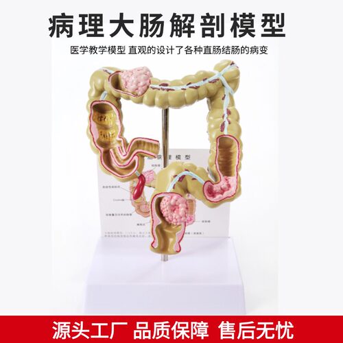 人体大肠病理模型 肠胃解剖模型 大肠 盲肠 直肠 十二指肠模型 - 图0