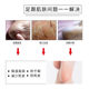 Junzhu's cracking socks, cracked socks, anti -foot cracks, fissure, foot crack socks, men and women autumn and winter cotton socks heels