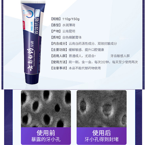 云南白药双效抗过敏牙膏150g 护理牙龈 牙齿敏感清新口气去牙渍 - 图1