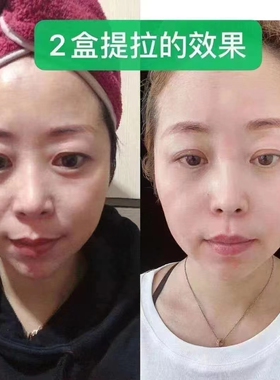 抗皱纹抗衰老紧致提拉面膜