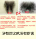 Fake pubic hair, simulated pubic hair, body-fitting hair for men and women, natural invisible traceless effect, real for men and women