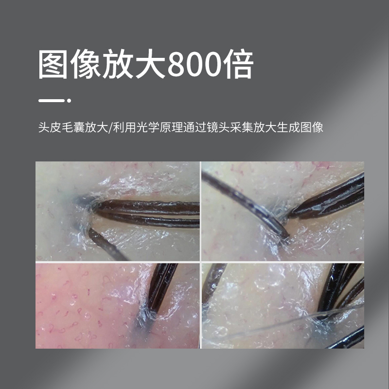 高清800X沙龙家用皮肤分析仪头皮检测仪接安卓ios无线链手机平板 - 图0