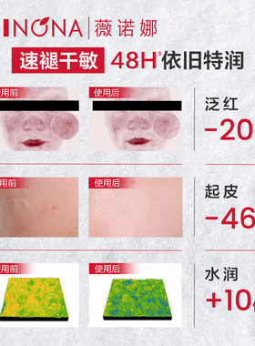 【新品尝鲜派样】 薇诺娜第二代特护滋润霜5g 干敏肌面霜舒缓修护