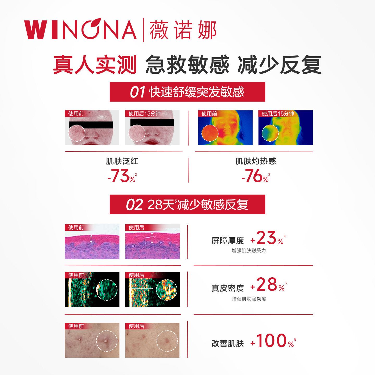 【周柯宇同款】第二代薇诺娜特护霜敏感肌面霜修护舒敏保湿护肤品