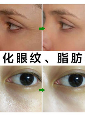 抗皱纹熬夜脂肪粒眼霜