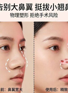 可调弯矫正鼻翼宽大缩小鼻夹贴