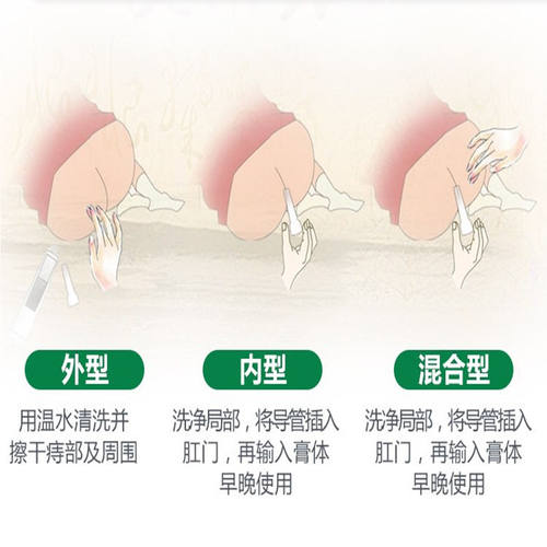 苗先锋草本痔疮膏正品华佗痔痔膏肛周瘙痒本草痔消膏孕妇屁舒膏 - 图0