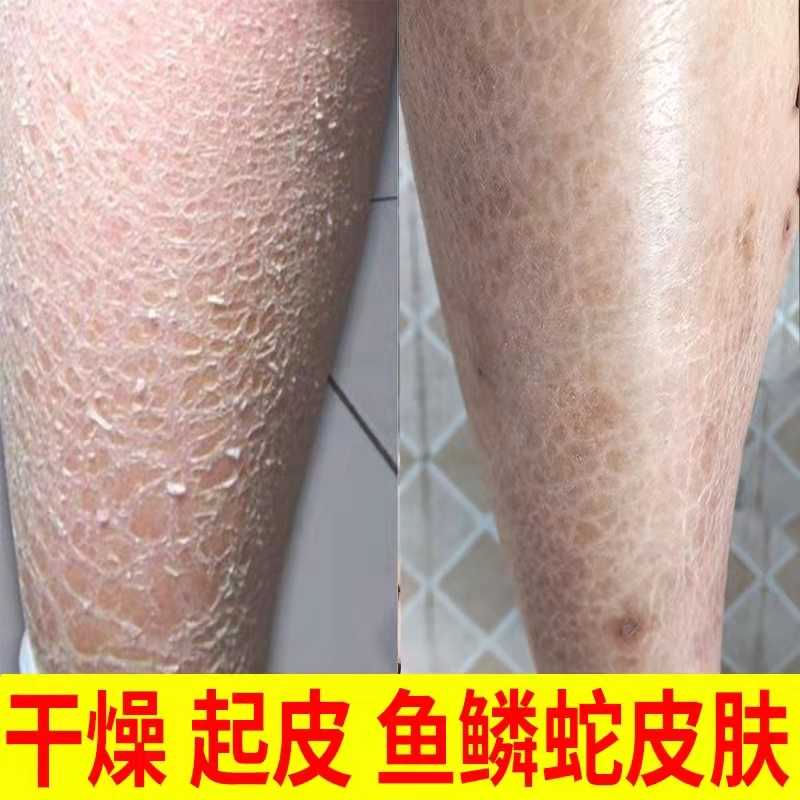 鱼鳞足 新人首单立减十元 21年12月 淘宝海外