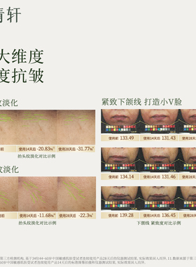 【专属货品】林清轩山茶花4.0精华油修护以油养肤淡纹官方正品MS