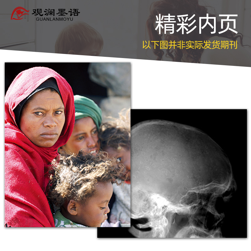 【单期现货/全年预定】The Lancet 柳叶刀 全年52期订购订阅 英国医学理论自然科学杂志 - 图1