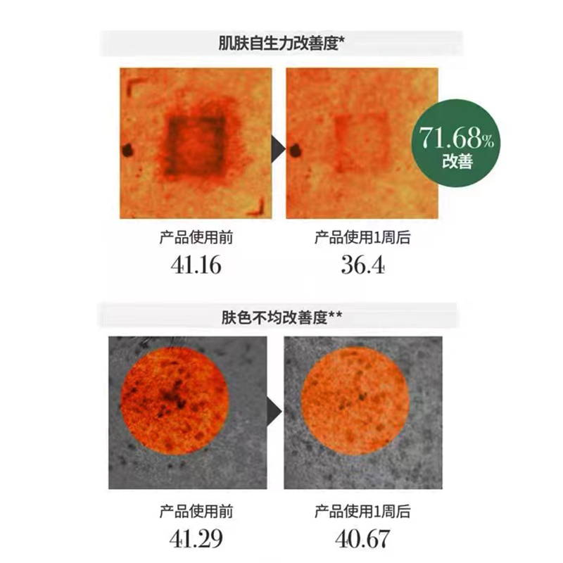 MEDIHEAL/美迪惠尔积雪草舒缓面膜补水保湿舒缓泛红10片 - 图2